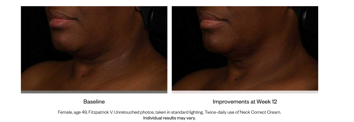 Neck Correct Cream