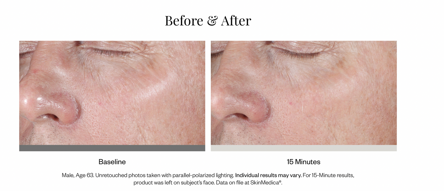 HA⁵® Rejuvenating Hydrator