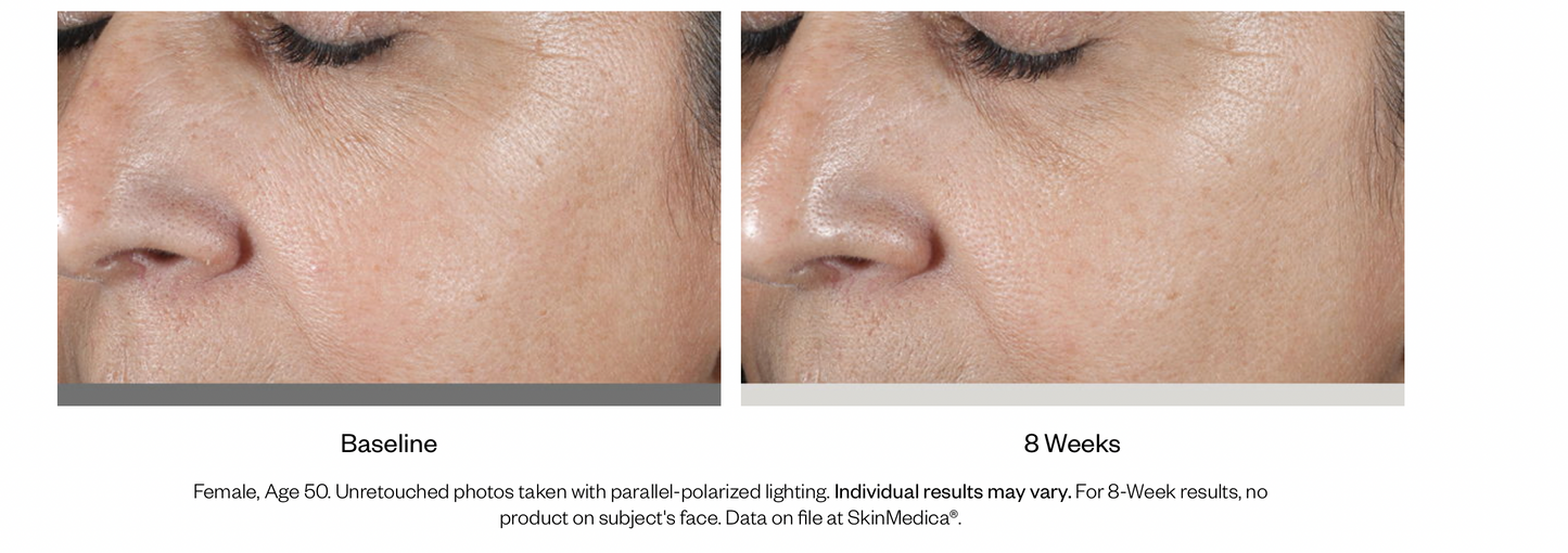 HA⁵® Rejuvenating Hydrator