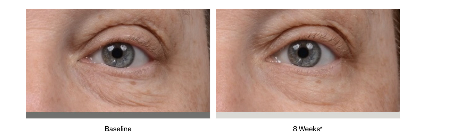 Instant Bright Eye Cream