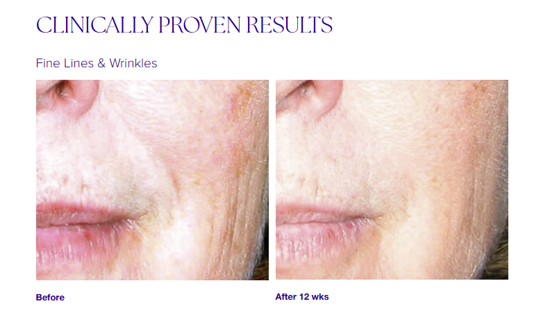 Active Serum