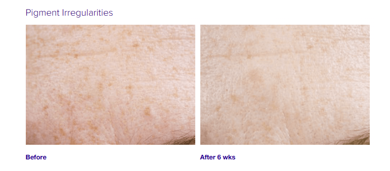 Active Serum