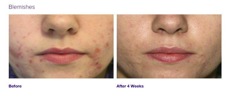 Active Serum