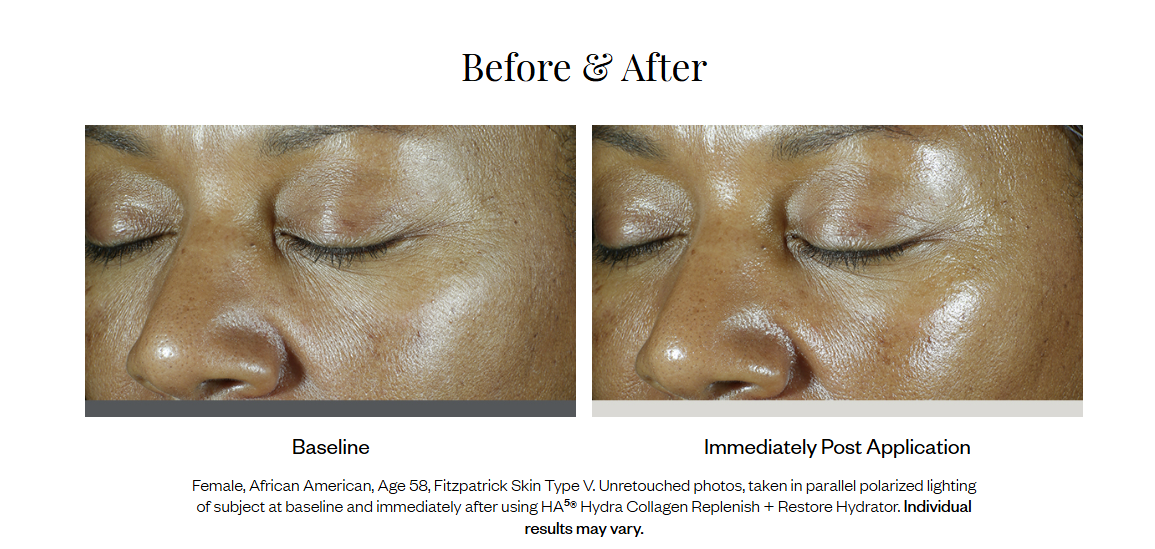 HA⁵® Hydra Collagen Replenish + Restore Hydrator