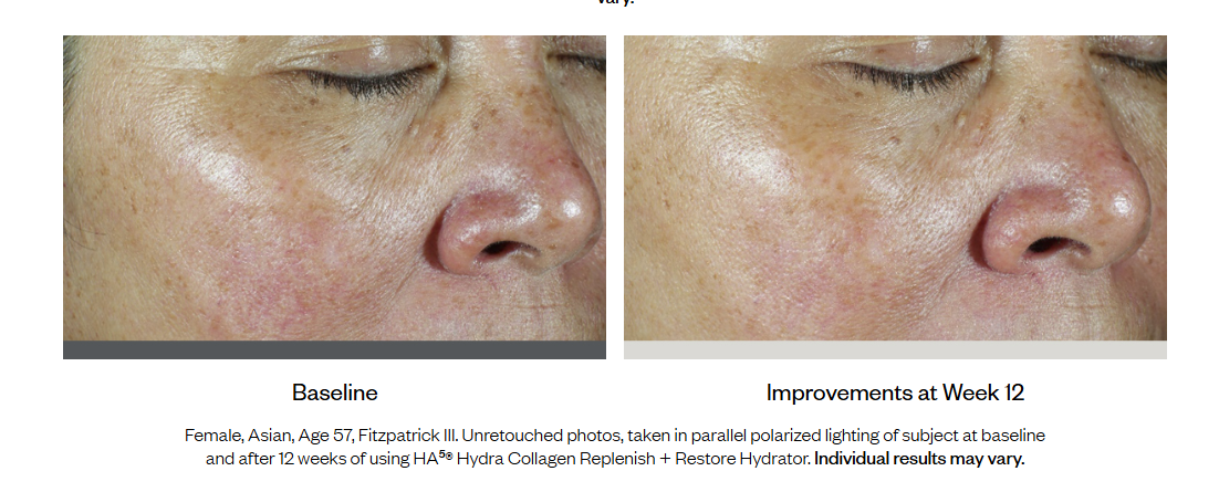HA⁵® Hydra Collagen Replenish + Restore Hydrator