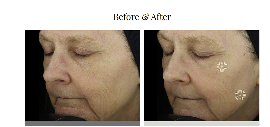 TNS® Advanced+ Serum