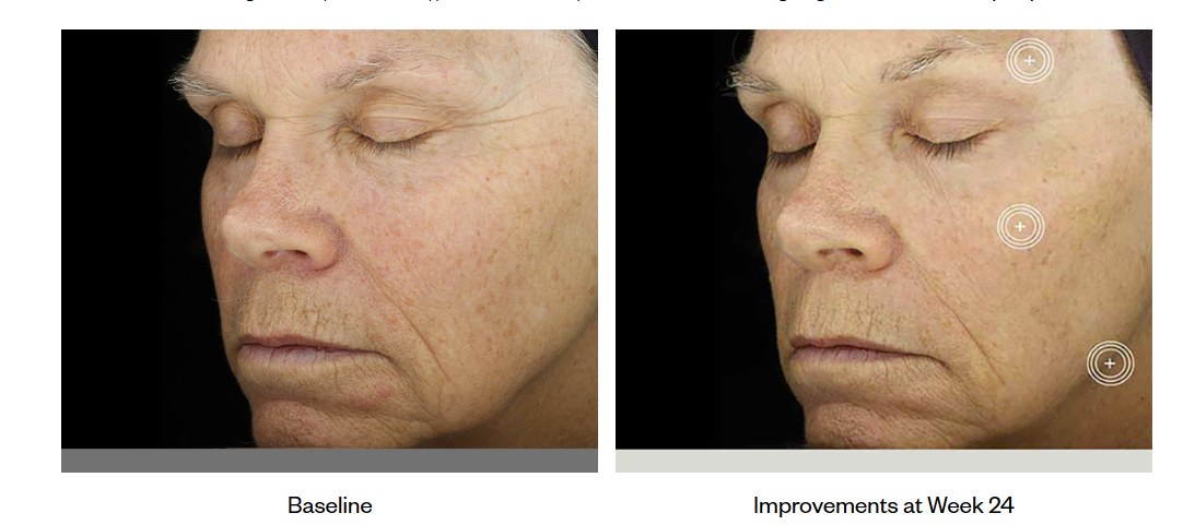 TNS® Advanced+ Serum