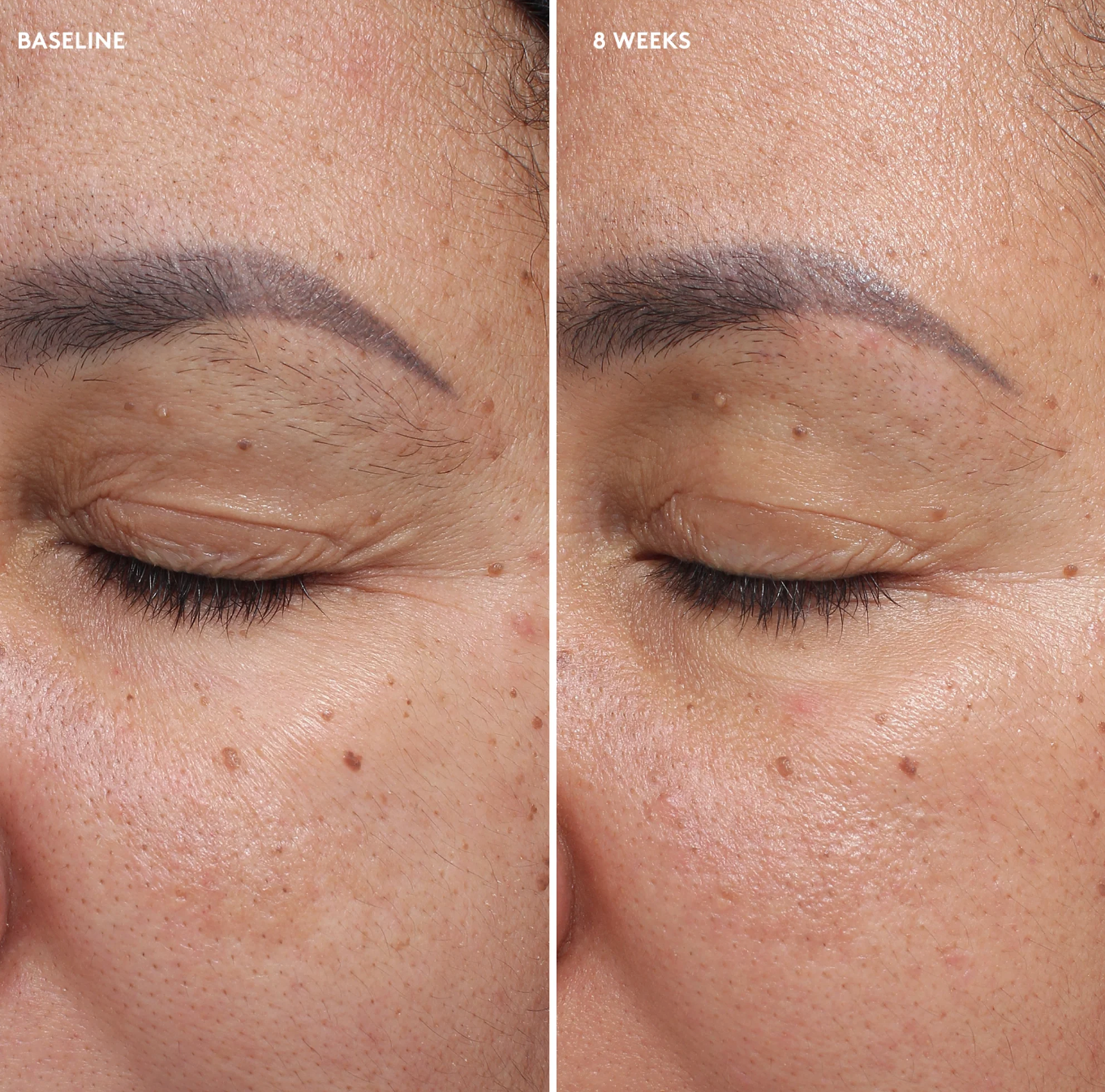 Total Eye® Firm & Repair Cream