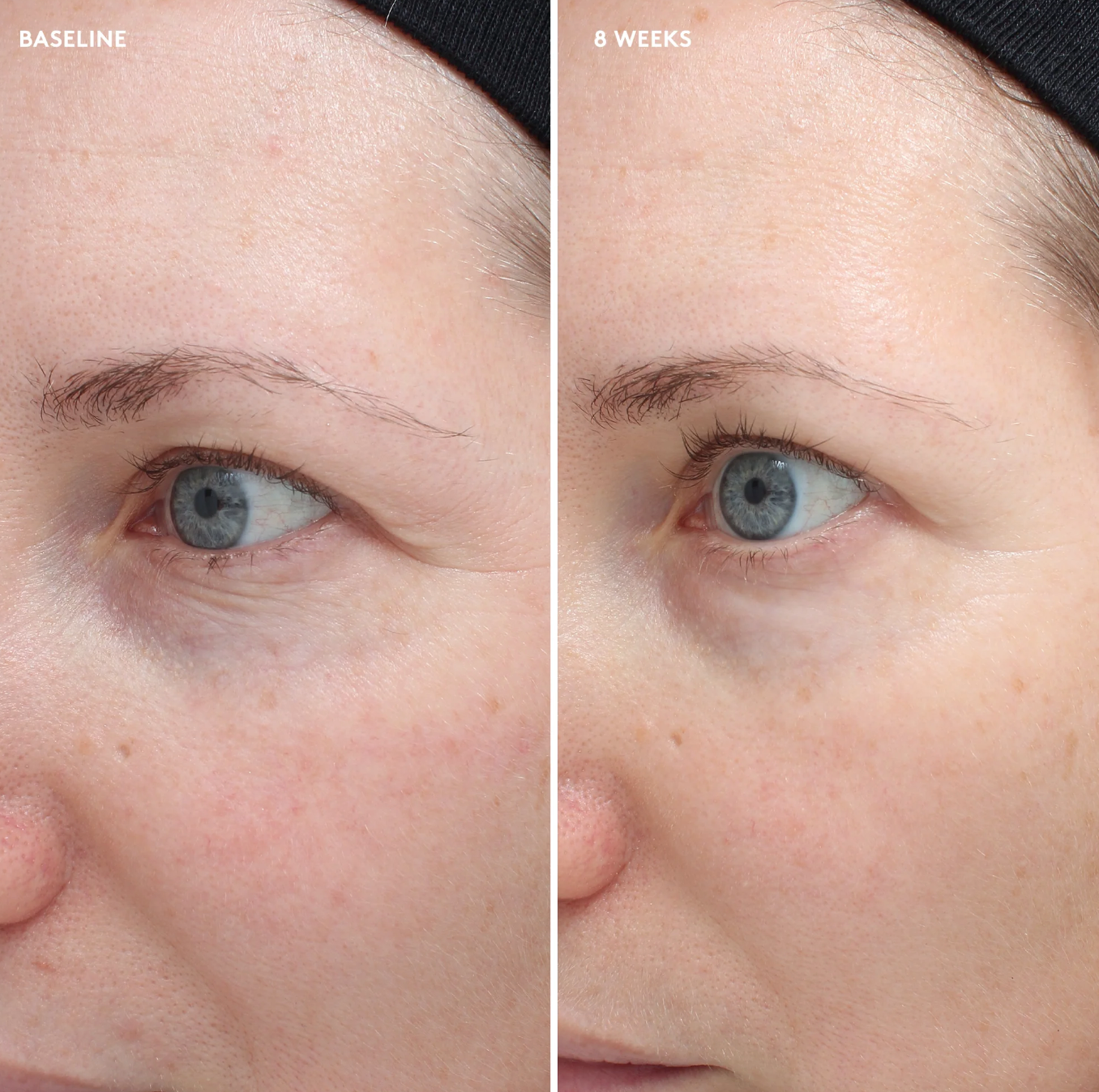 Total Eye® Firm & Repair Cream