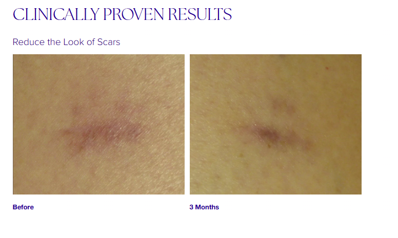 Super Serum Advance+