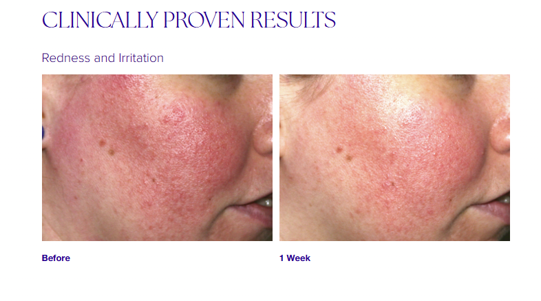 Pro-Heal Serum Advance+