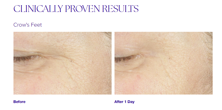 Youth Intensive Crème