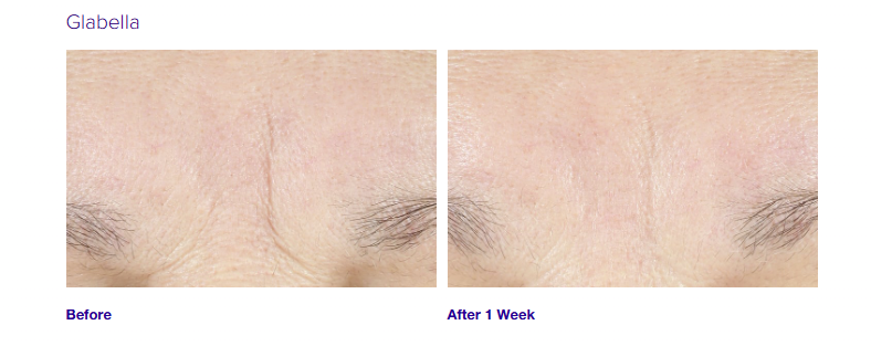 Youth Intensive Crème