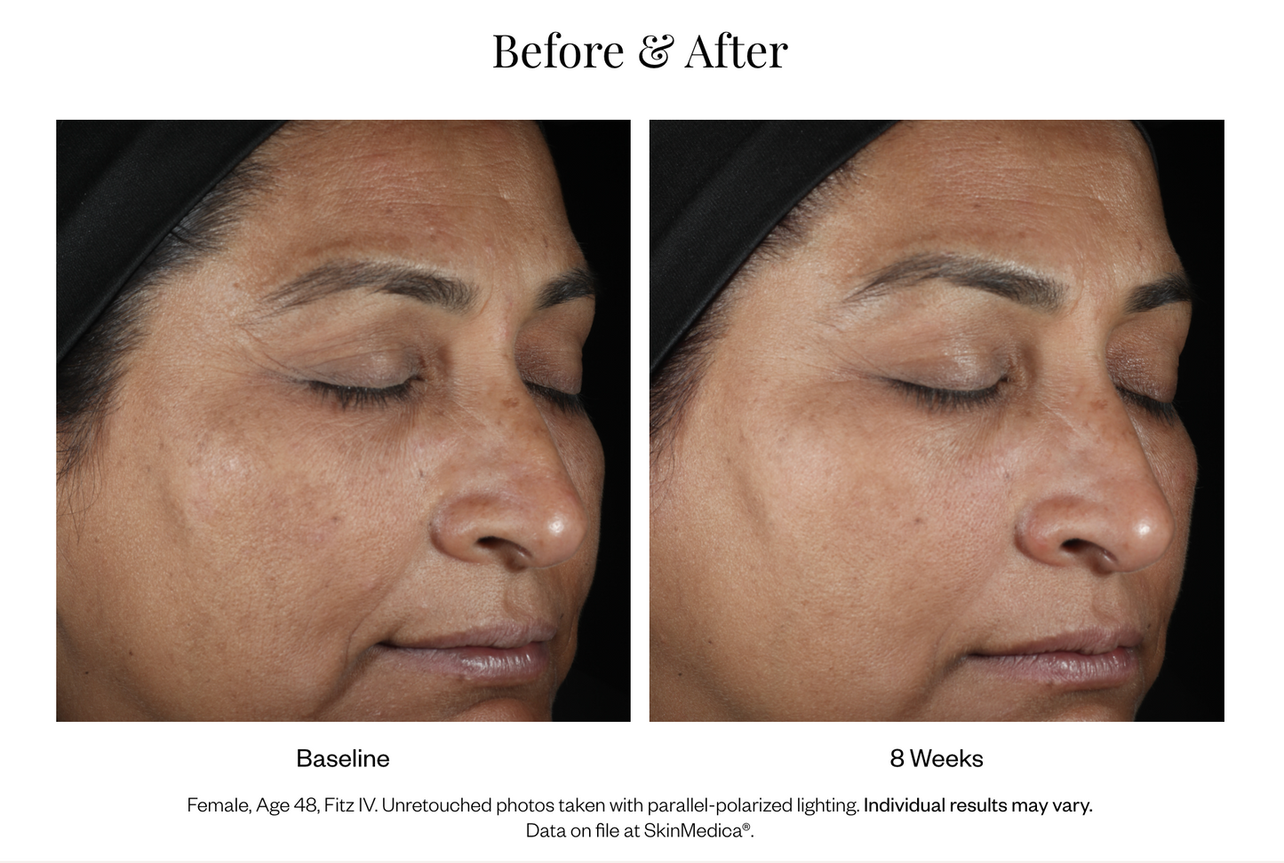 LUMIVIVE® System