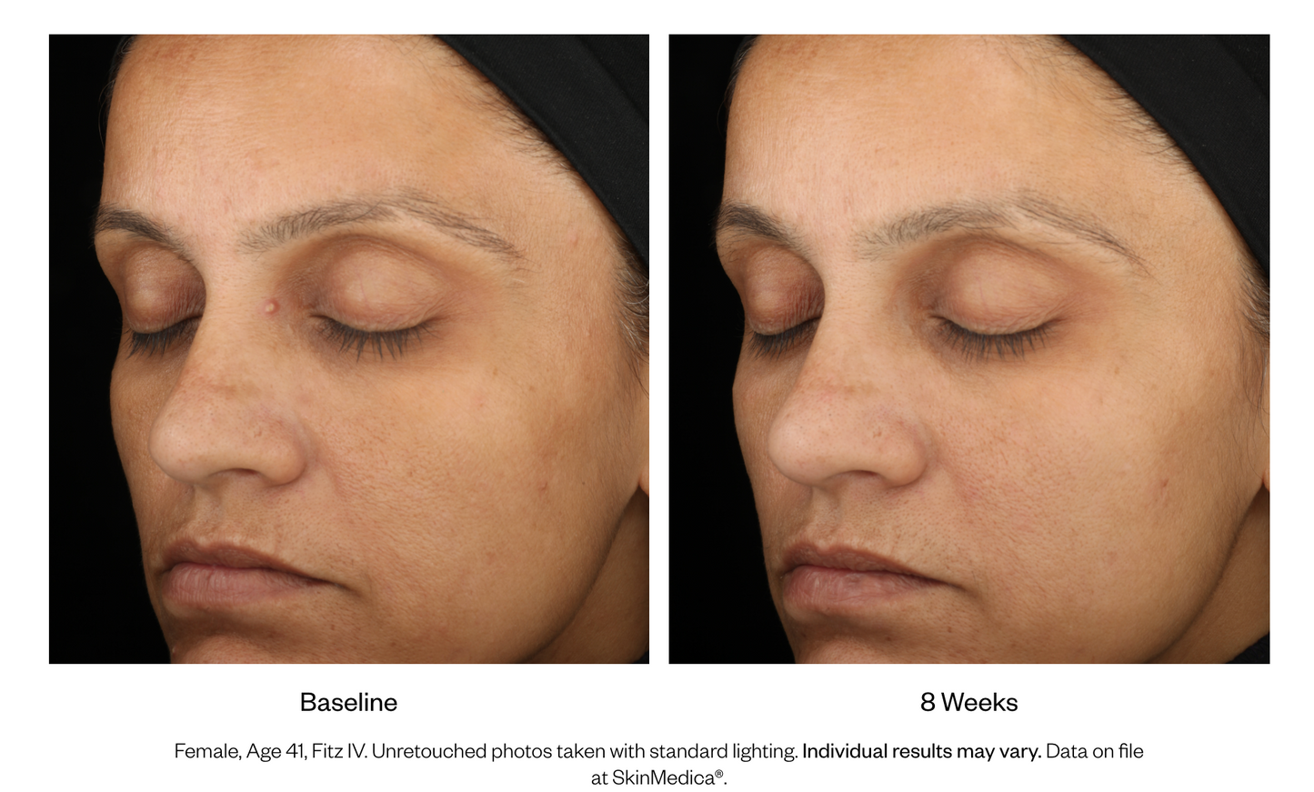 LUMIVIVE® System