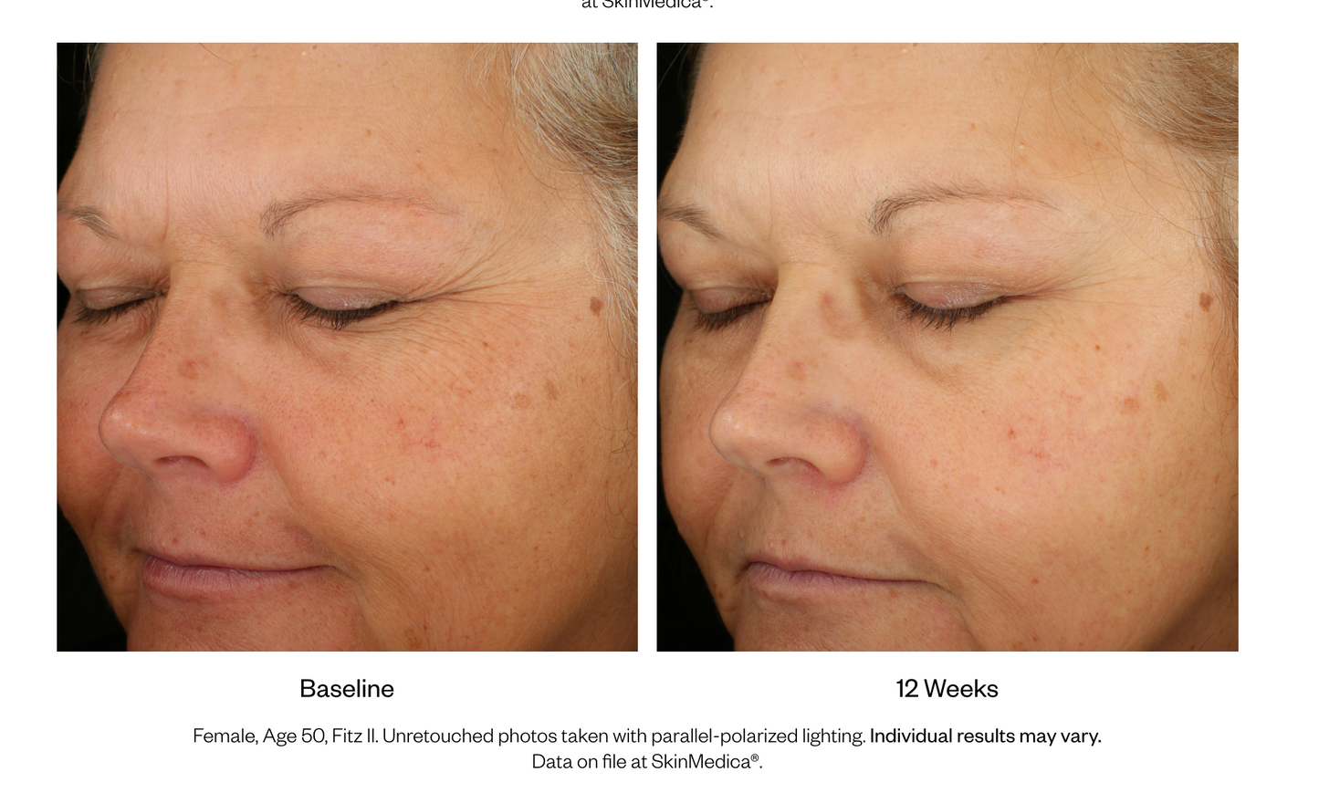 LUMIVIVE® System