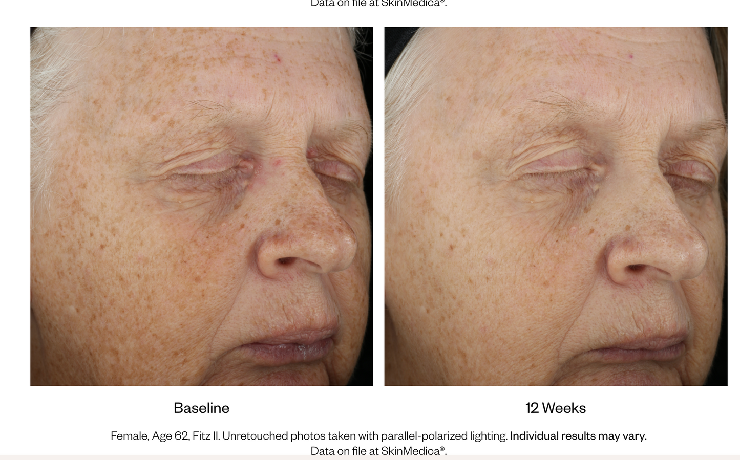 LUMIVIVE® System