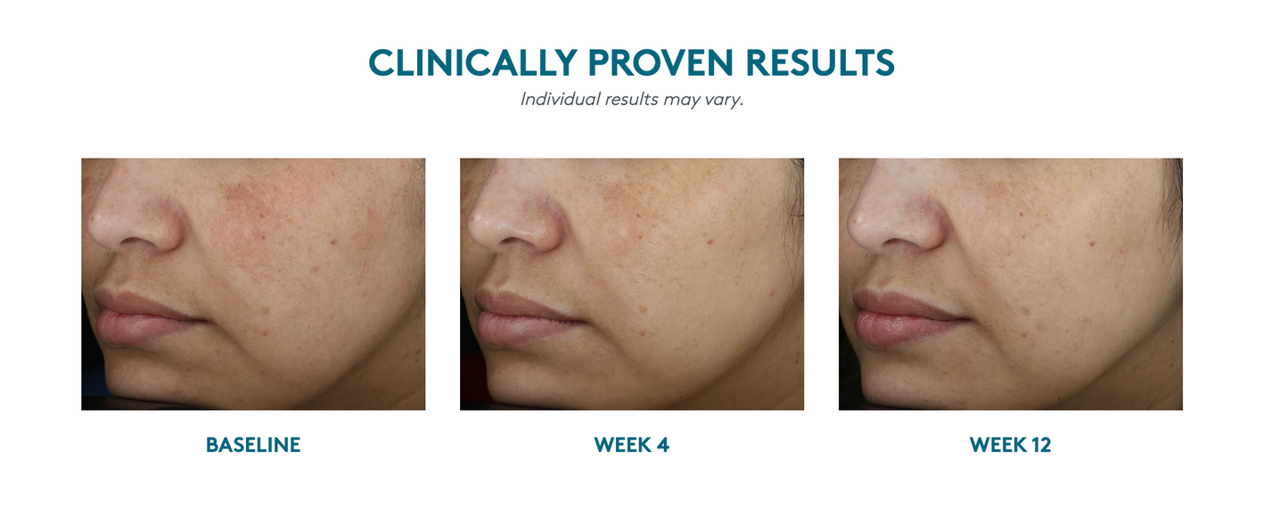 Even Up® Multi-Correction Serum