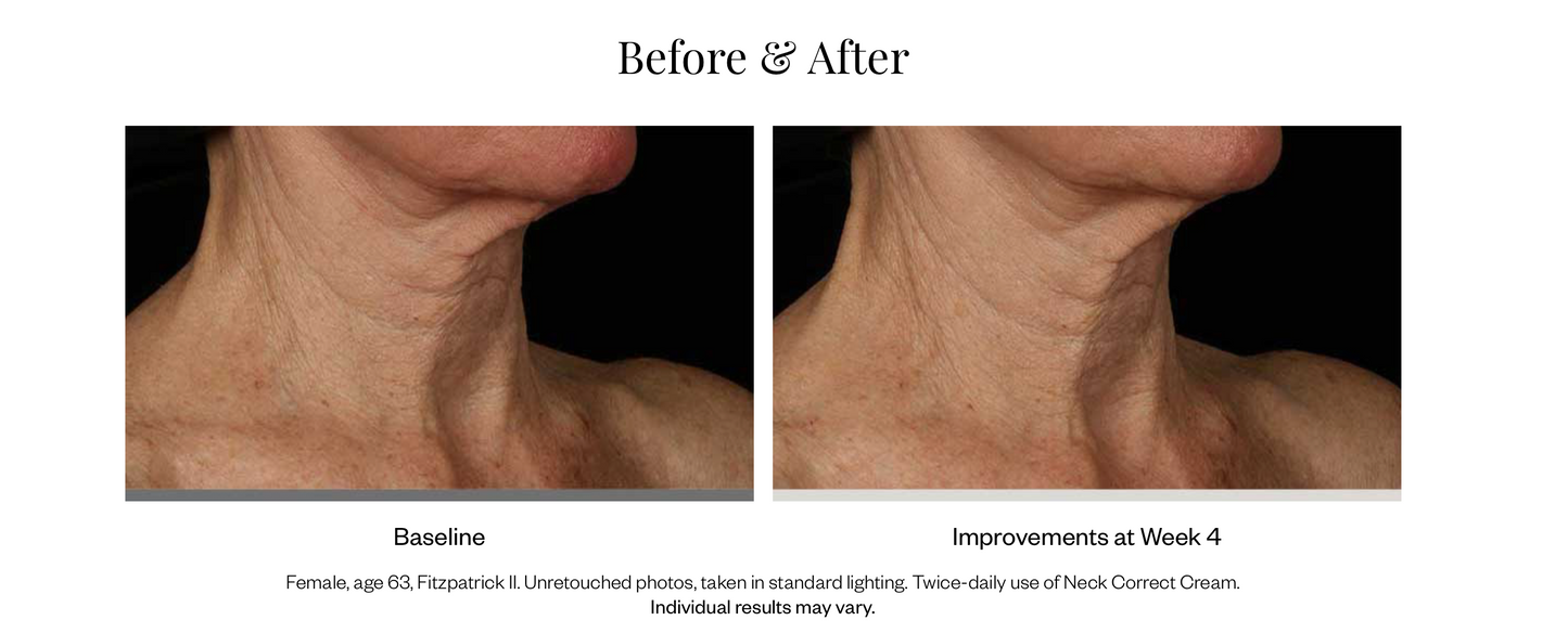 Neck Correct Cream