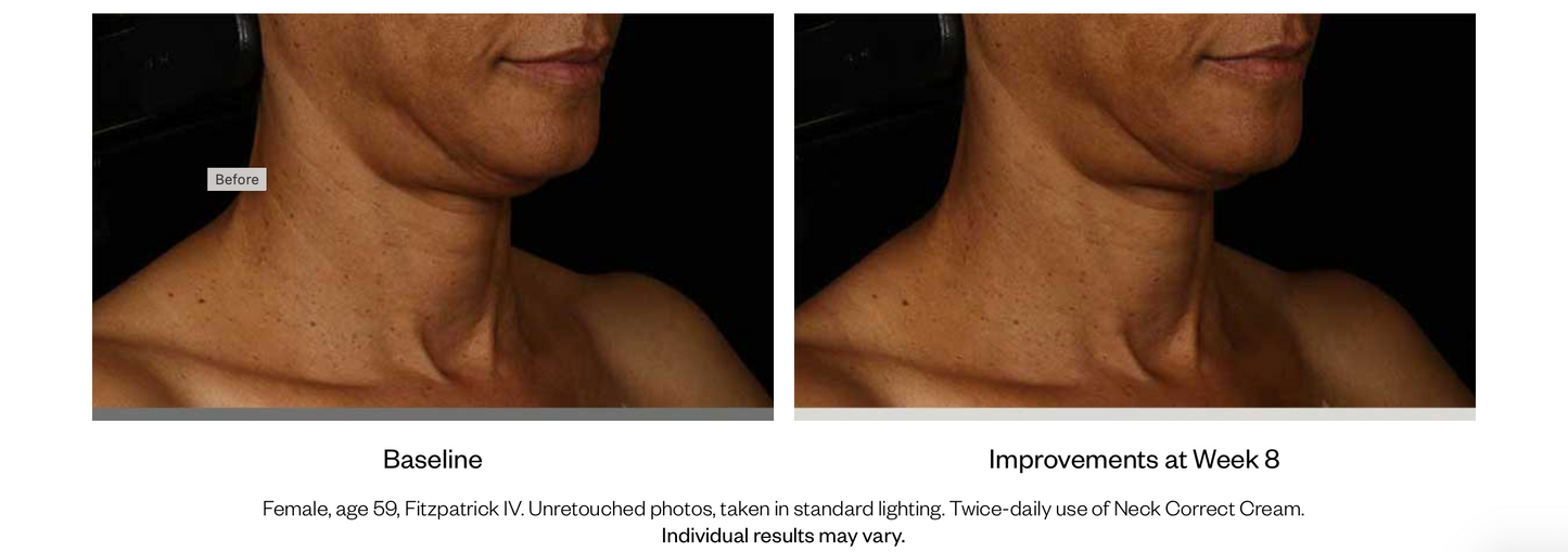 Neck Correct Cream