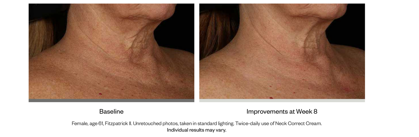 Neck Correct Cream