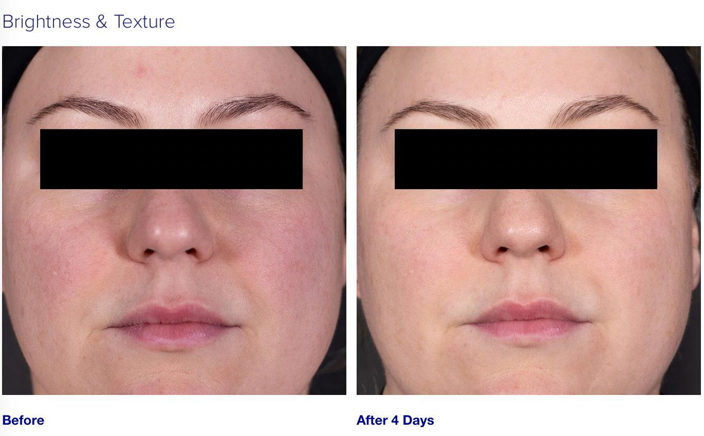 RETINOL+ EMULSION 0.3