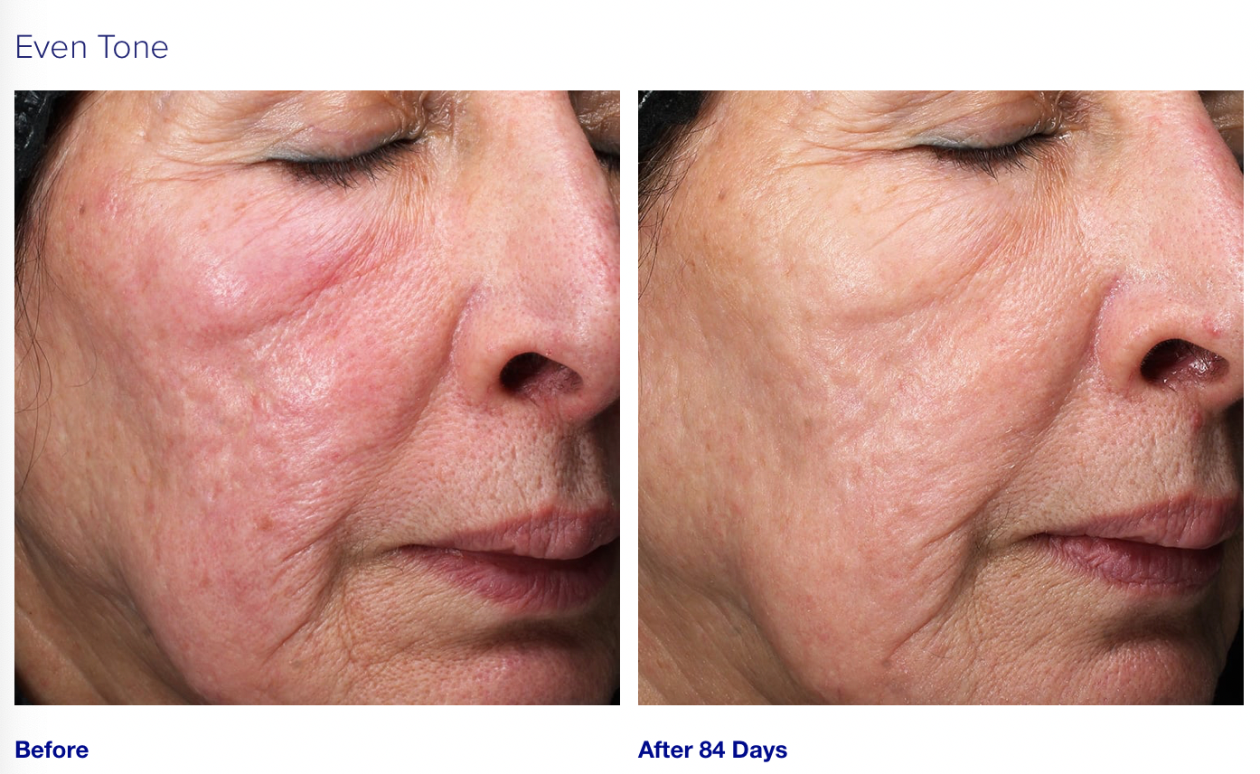 RETINOL+ EMULSION 0.3