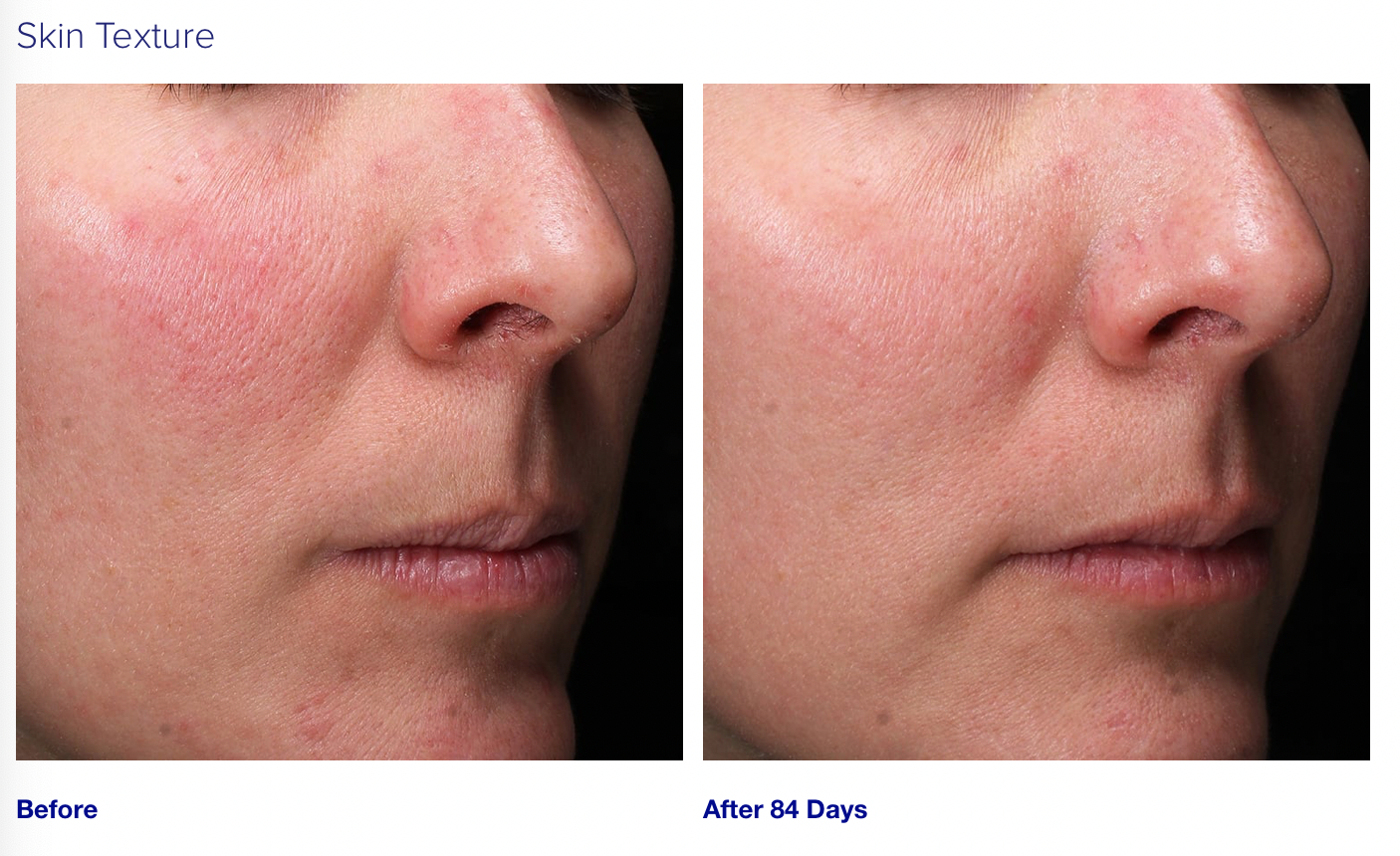 RETINOL+ EMULSION 0.3