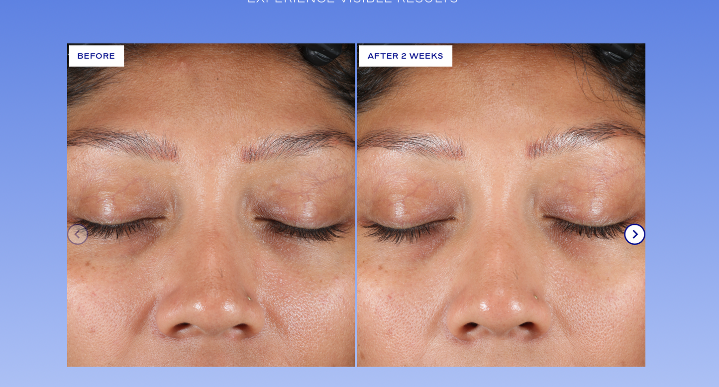 Extra Strength Active Peel Brightening System