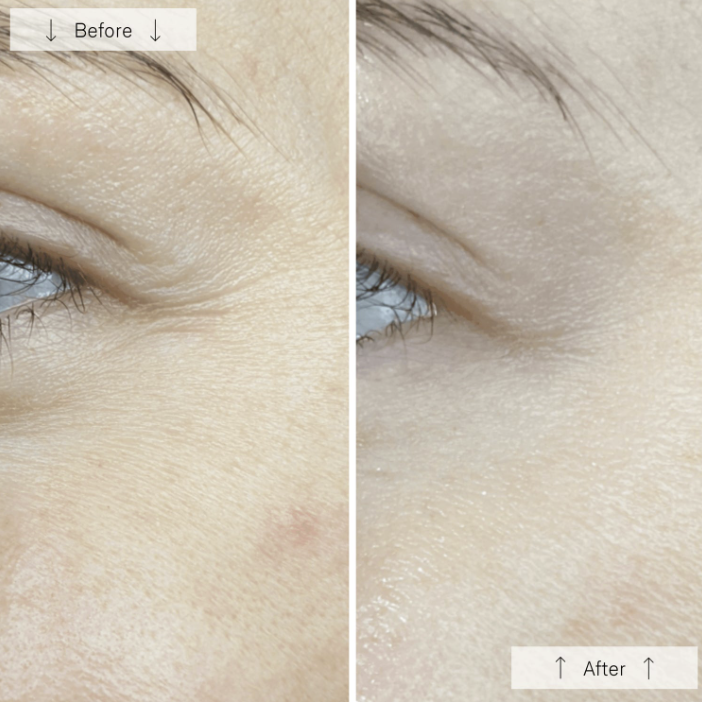 Omnilux Contour Face