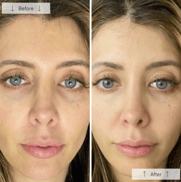 Omnilux Contour Face