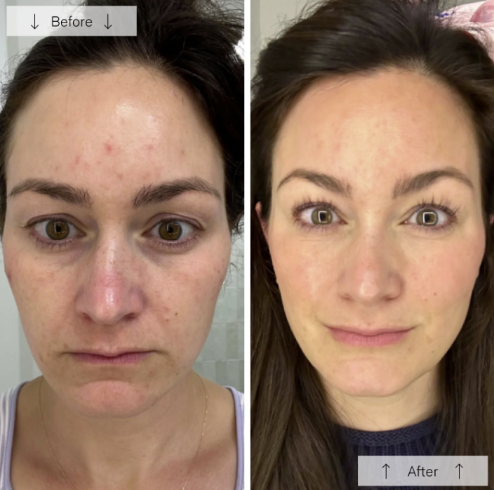 Omnilux Contour Face