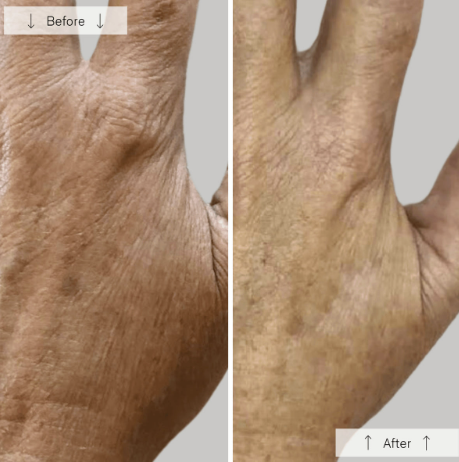 Omnilux Contour Glove