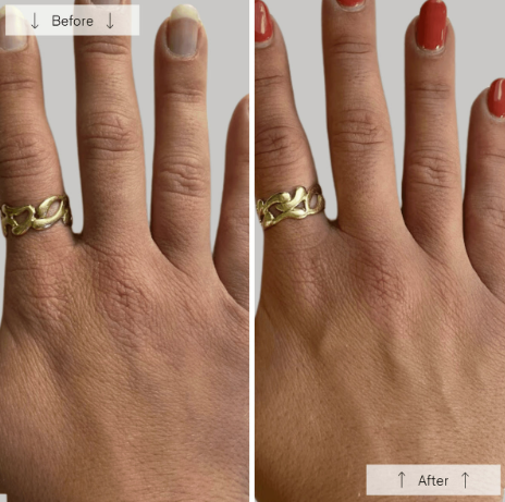 Omnilux Contour Glove