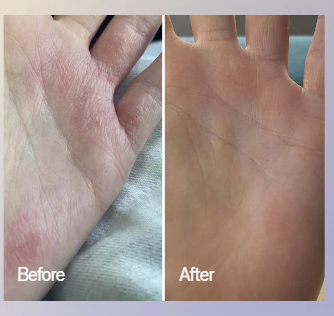 Omnilux Contour Glove
