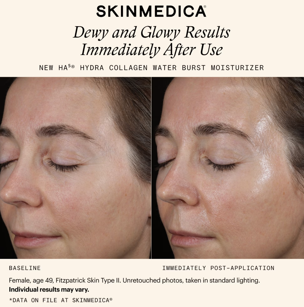 SkinMedica HA5 Hydra Collagen Water Burst Moisturizer (1.7 fl. oz.)