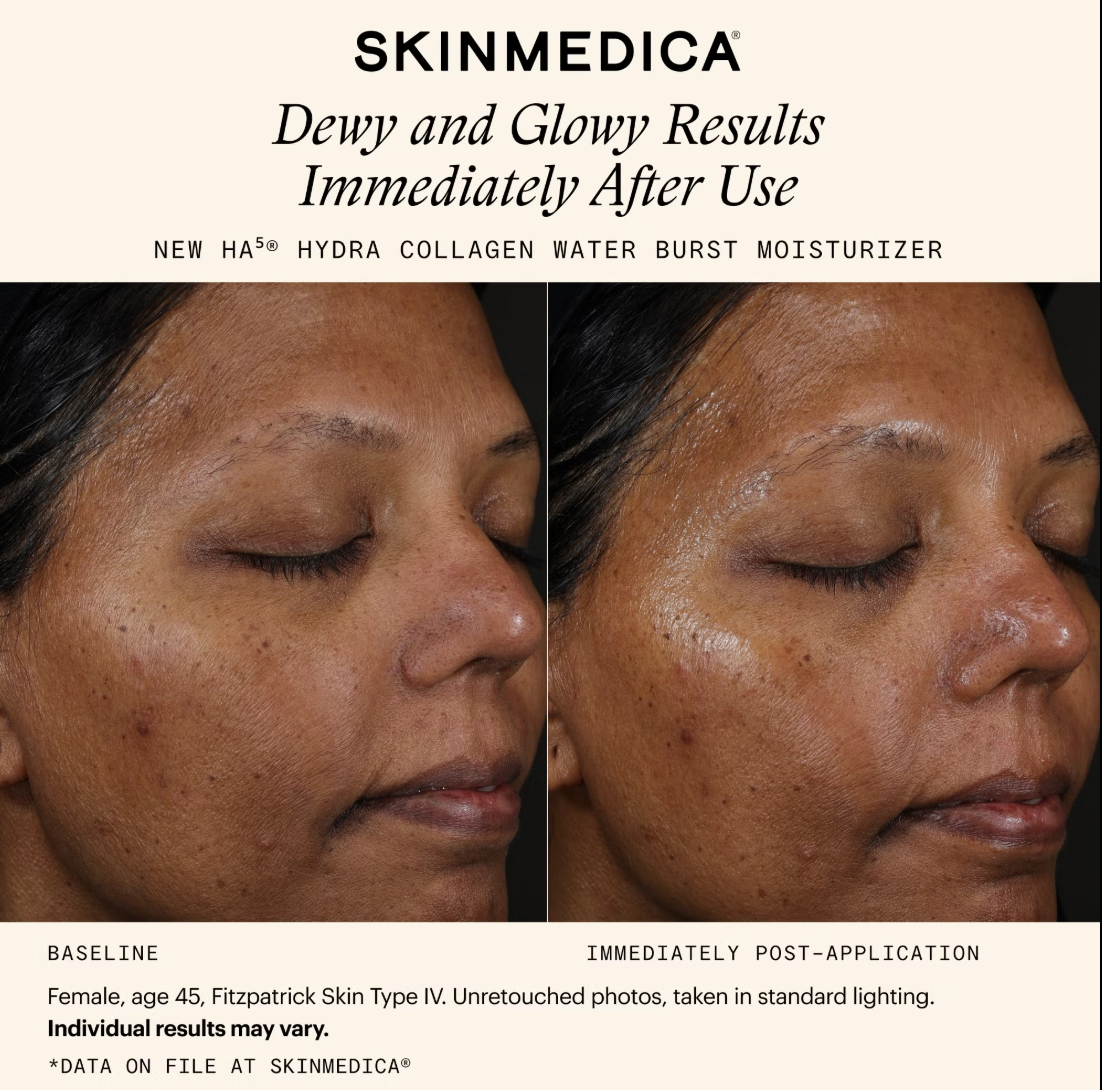 SkinMedica HA5 Hydra Collagen Water Burst Moisturizer (1.7 fl. oz.)