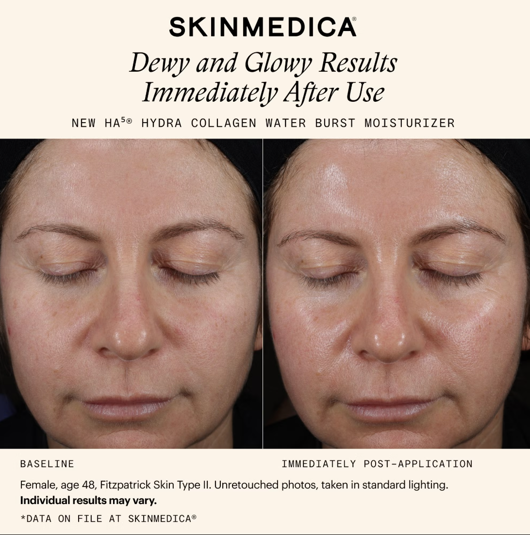 SkinMedica HA5 Hydra Collagen Water Burst Moisturizer (1.7 fl. oz.)